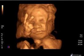 People! Enough with the flash!